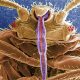 Bed bugs’ biggest impact may be on mental health after an infestation of these bloodsucking parasites