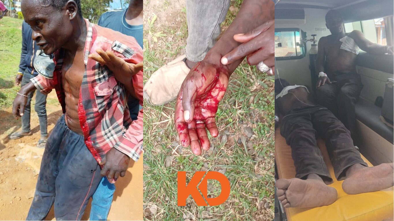 Injured men receiving treatment after violence at a political event in Ugunja.